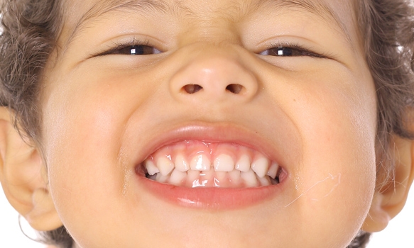 ¿Quieres saber cuándo se caerán los dientes de leche de tus hijos?