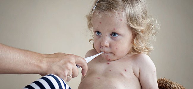 El cuidado de niños con sarampión, varicela y otras enfermedades infecciosas
