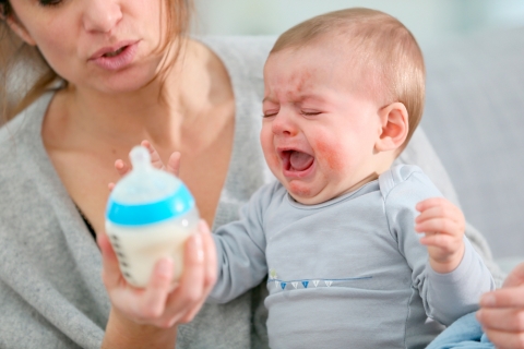 Las alergias en la alimentación infantil