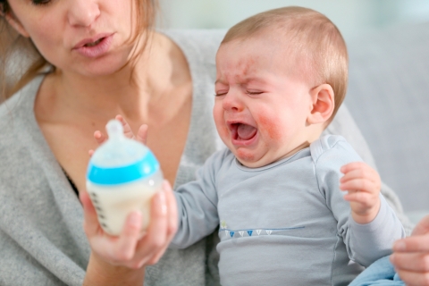 Alergias alimentación infantil