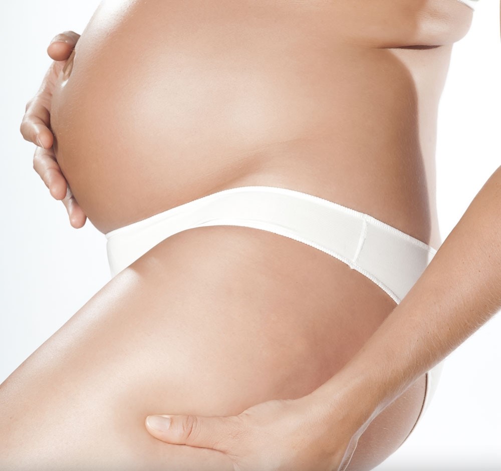 Todo lo que debes saber sobre la celulitis y el embarazo