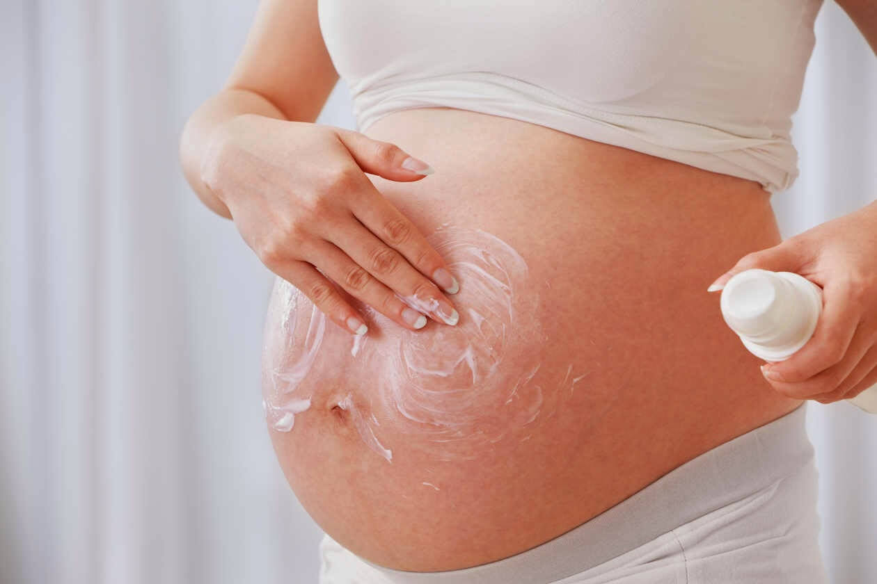 Prevenir las estrías durante el embarazo