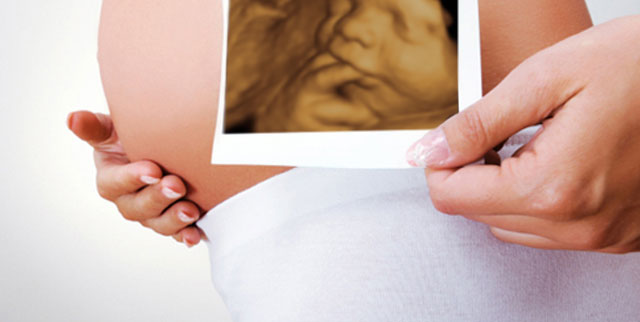 Una clínica entrega las mismas ecografías 3D a varias embarazadas