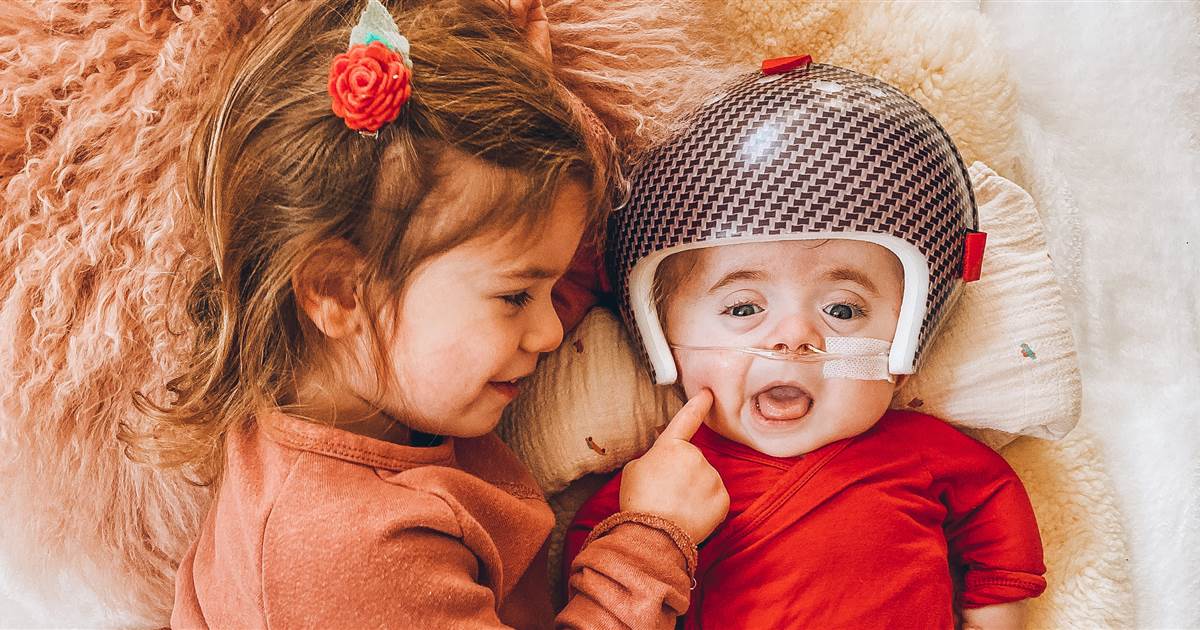 Cómo esta mamá y su bebé están desmitificando los cascos craneales