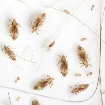 Tratamiento de los piojos, síntomas, causas de la infestación, imágenes, remedios