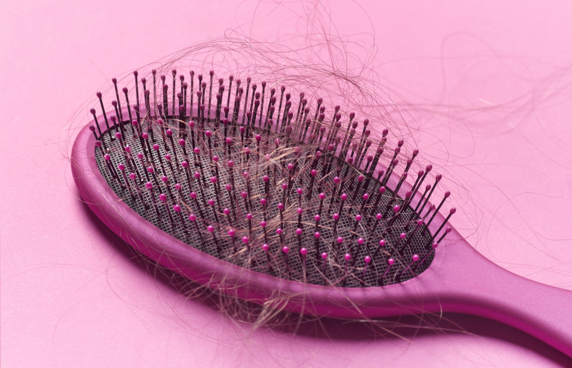 ¿Pueden los anticonceptivos provocar la caída del cabello?