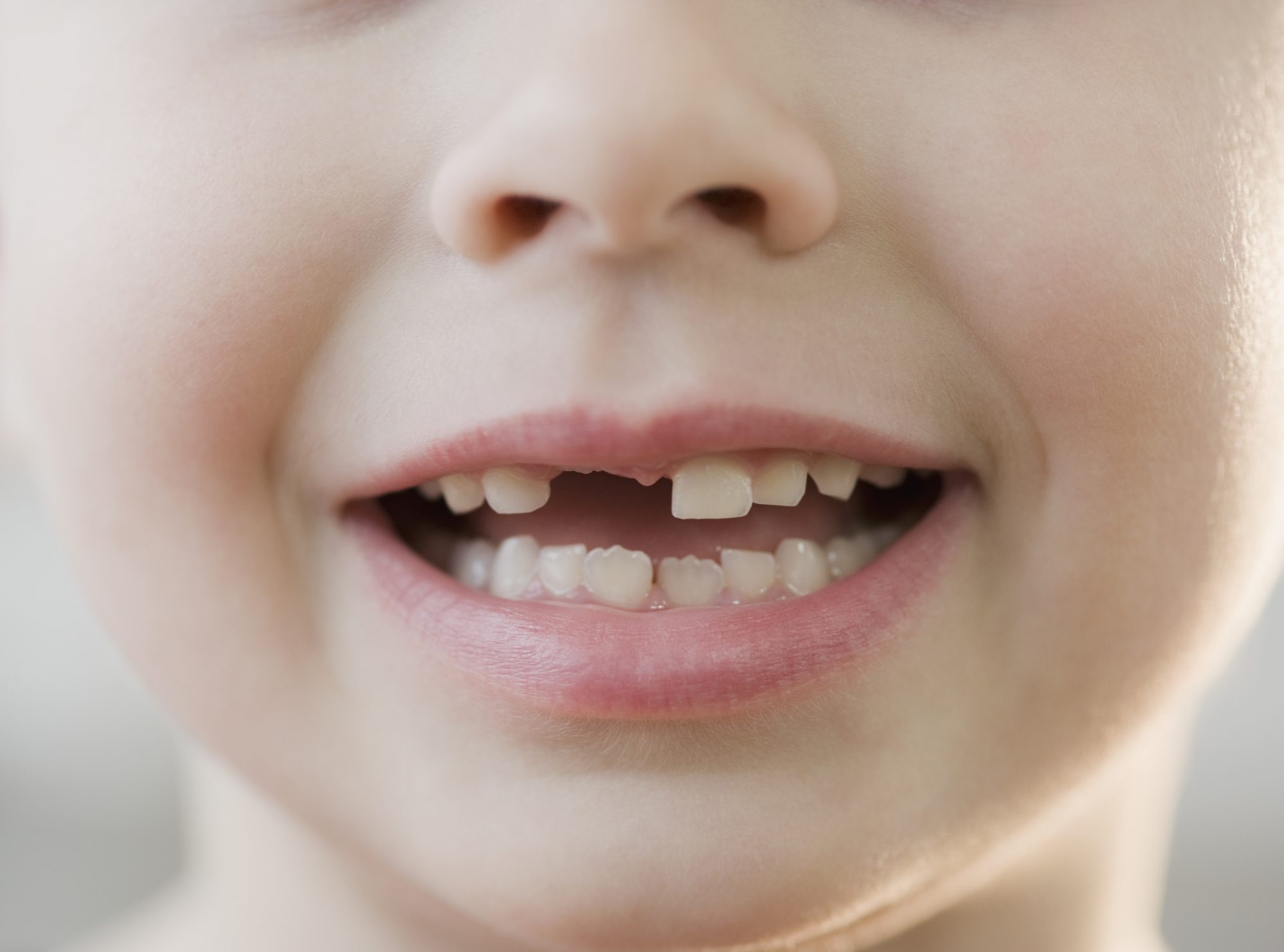 Los niños y la falta de dientes: lo que todos los padres deberían saber