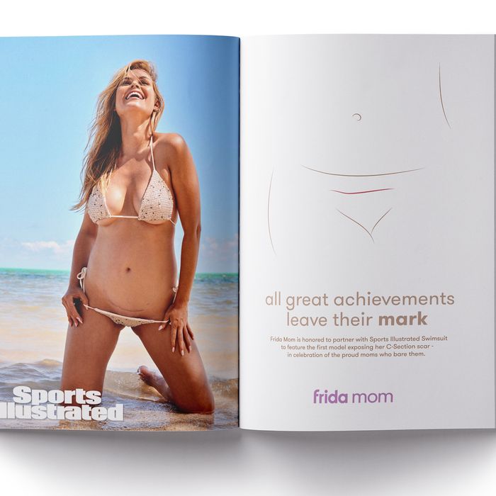 Una modelo con una cicatriz de cesárea aparece en el número 2022 de Sports Illustrated 'Swimsuit'