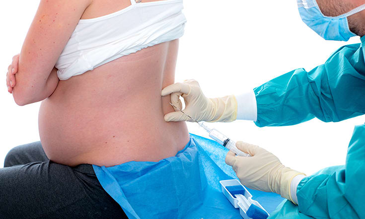 Seis cosas que debe saber sobre la epidural