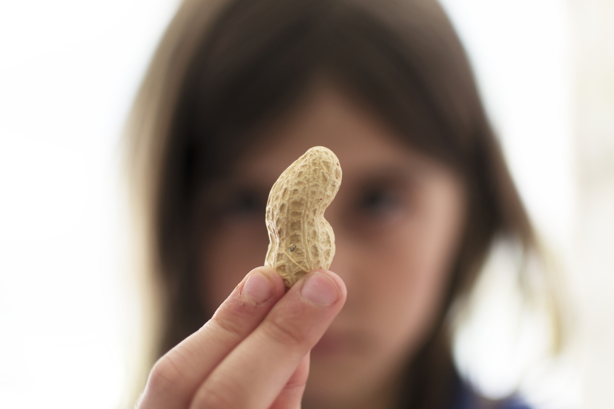 El "parche de cacahuete" podría cambiar la vida de los niños alérgicos