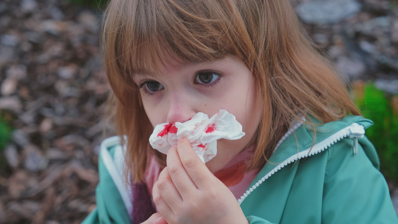Qué significa la hemorragia nasal en los niños y cómo tratarla