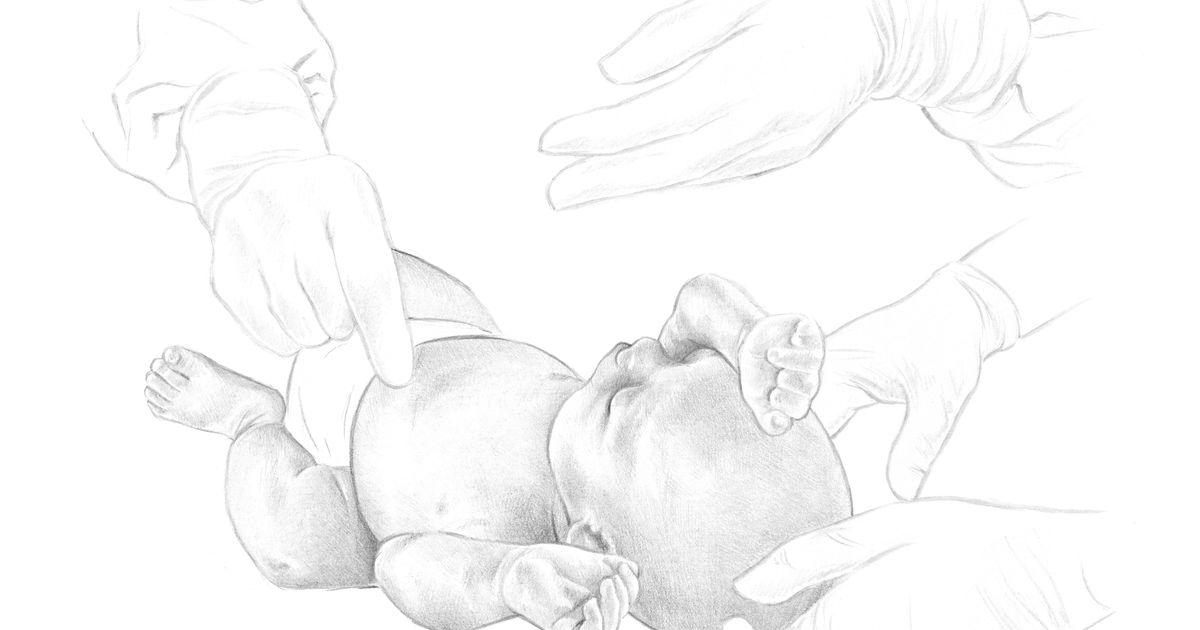 La madre que tuvo tres bebés con fibrosis quística