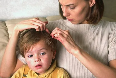 Desafortunadamente, es casi imposible prevenir todas las infestaciones de piojos de cabeza.