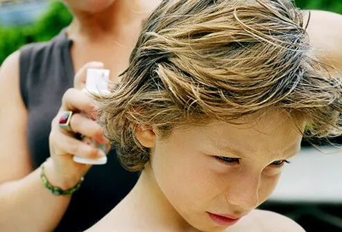 La mayoría de los tratamientos tópicos contra los piojos están disponibles sin receta; sin embargo, dado que algunos de los ingredientes pueden no estar recomendados para niños pequeños, siempre discuta las opciones con un profesional de salud.